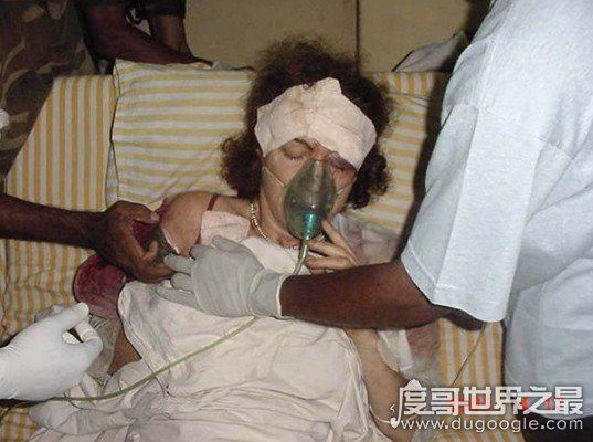 战地女记者玛丽·科尔文，采访中眼睛被炸瞎(用生命记录战争)