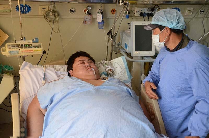 中国最胖的人,相当于四个你的体重(中国第一胖)