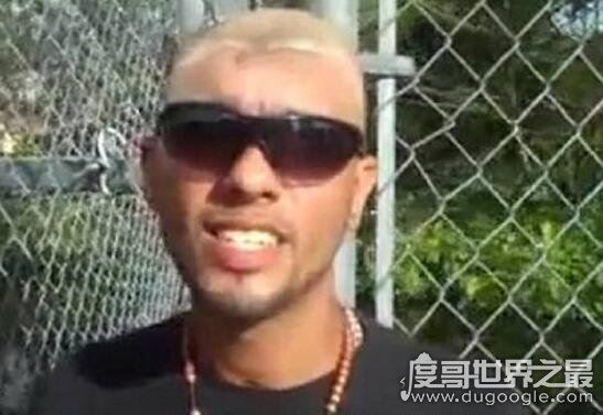 半脑哥卡洛斯不但存活下来,少了半个脑袋的他智商还非常高