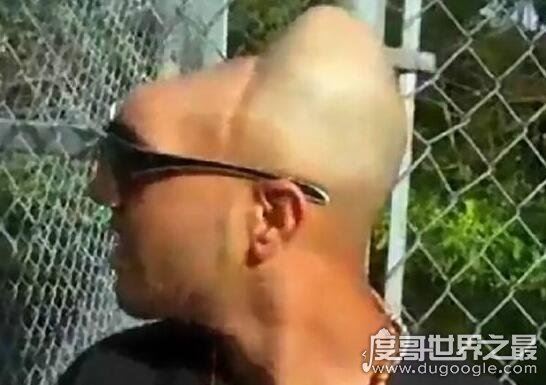 半脑哥卡洛斯不但存活下来,少了半个脑袋的他智商还非常高