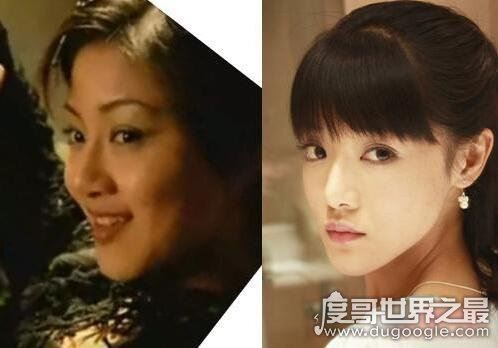邓家佳整容前后照对比,完全看不出原来的样子(就像换了个人)