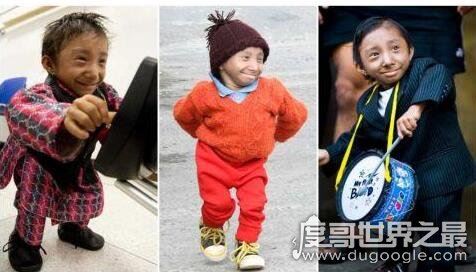 尼泊尔世界最矮的人去世享年28岁，生前身高仅67.08厘米