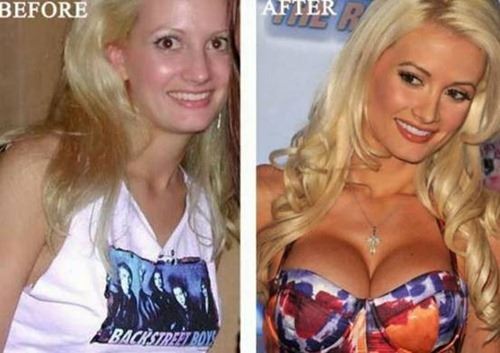 欧美十大女明星最昂贵的隆胸手术，帕姆·安德森花了20万