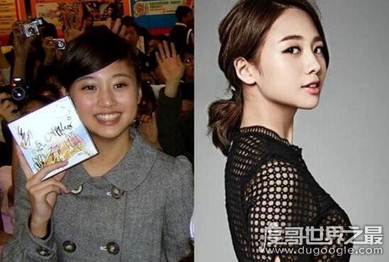 鬼鬼吴映洁整容前后照片对比，大方承认在韩国微整