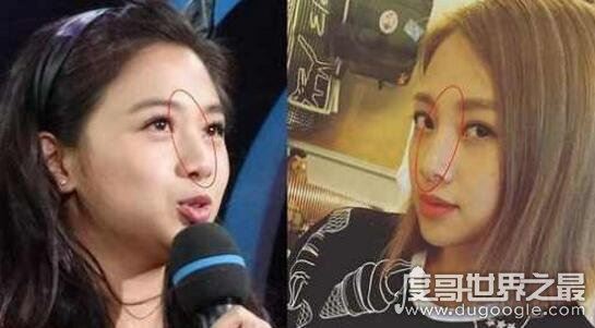 鬼鬼吴映洁整容前后照片对比，大方承认在韩国微整