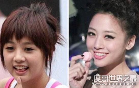 鬼鬼吴映洁整容前后照片对比，大方承认在韩国微整