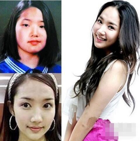 韩国女星朴敏英整容前后照片对比,丑女大翻身(整容前丑爆了)