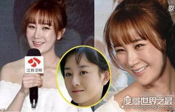 张檬整容前后照片对比,好好的一张美人脸被整残(判若两人)