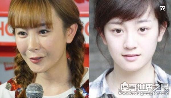 张檬整容前后照片对比，好好的一张美人脸被整残(判若两人)