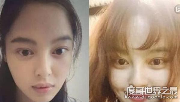 张檬整容前后照片对比，好好的一张美人脸被整残(判若两人)