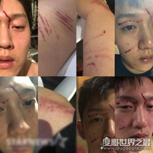 具荷拉男友家暴事件大反转，被打子宫出血还受到情爱视频威胁