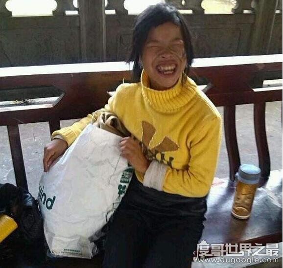 雅安网红琼姐的资料简介,轻度残障人士被包装成网红(交帅气男友)