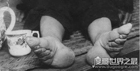 裹脚是从什么时候开始的,缠足是从南唐李煜时期开始