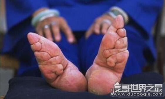 裹脚是从什么时候开始的，缠足是从南唐李煜时期开始