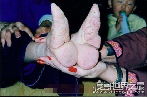 裹脚是从什么时候开始的，缠足是从南唐李煜时期开始