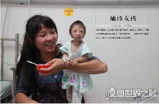 中国袖珍女孩盘点,最矮女孩小小仅54厘米(成世界最矮人)