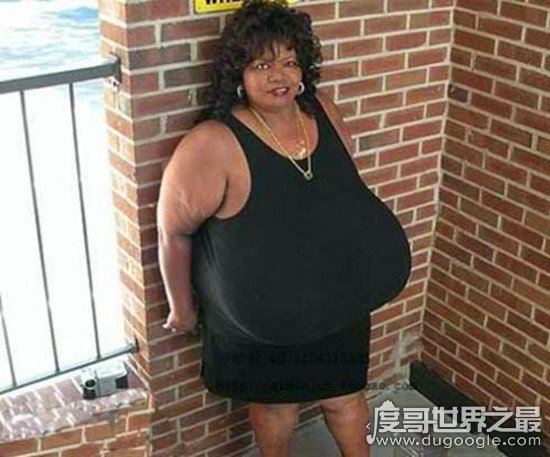 吉尼斯最大胸纪录保持者，斯蒂斯(胸围102ZZZ/胸重77斤)