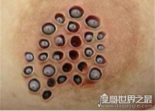 莲蓬乳是什么?像莲蓬一样的乳房竟是真的存在(慎入)