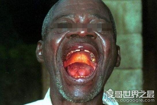 可怕的僵尸病毒埃博拉,感染病人诈尸死状十分恐怖