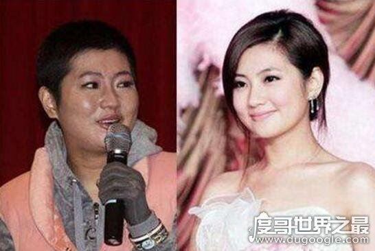 任家萱烧伤图片前后对比,身上全是疤痕(触目惊心)