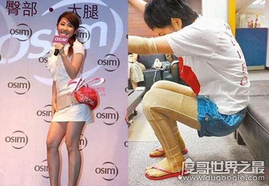 任家萱烧伤图片前后对比,身上全是疤痕(触目惊心)