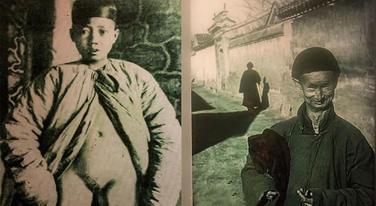 太监的净身过程图解，封建王朝太可怕了（重口味）