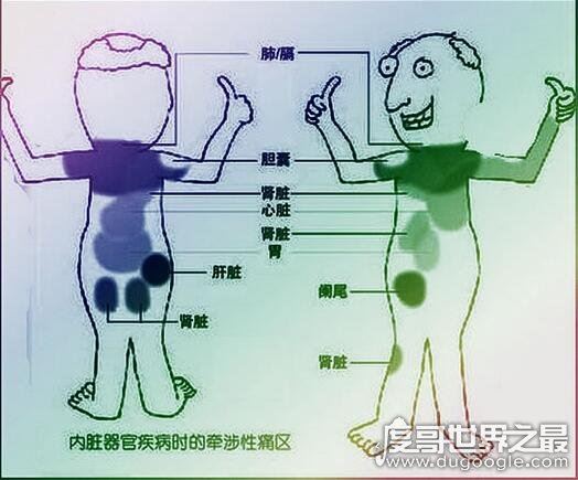 身体各个器官疼痛位置图片,切记不可"自诊"(仅做为参考)