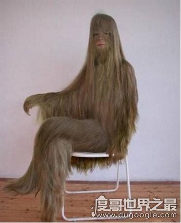 世界上毛最多的人是谁，艾米丽·苏珊(返祖现象所致)