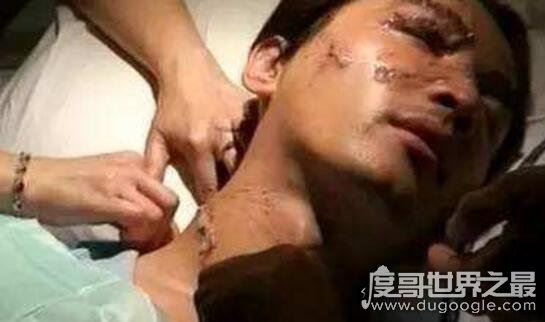 胡歌车祸原因诡异,胡歌车祸前后照片对比遭毁容