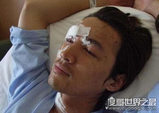 胡歌车祸原因诡异，胡歌车祸前后照片对比遭毁容