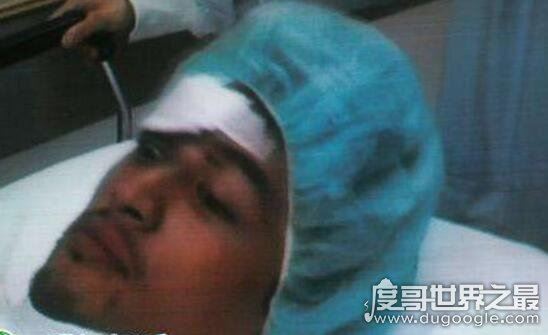 胡歌车祸原因诡异，胡歌车祸前后照片对比遭毁容