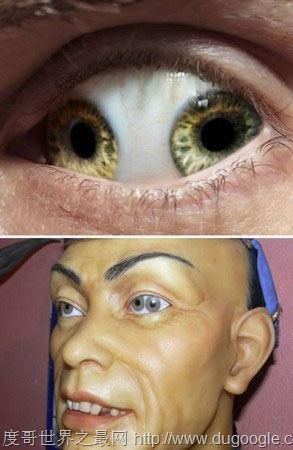 世界上有双瞳的人吗，双瞳孔是真实存在(我国就有不少)