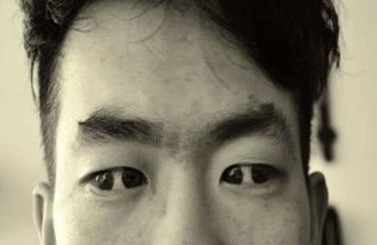 世界上有双瞳的人吗，双瞳孔是真实存在(我国就有不少)