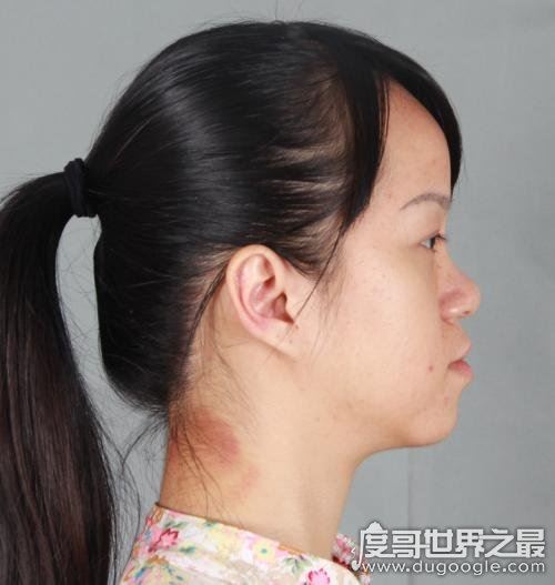 最丑的几种鼻子图片，每一种都会拉低颜值(塌鼻子大家公认最丑)