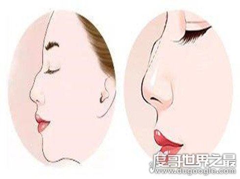 最丑的几种鼻子图片，每一种都会拉低颜值(塌鼻子大家公认最丑)