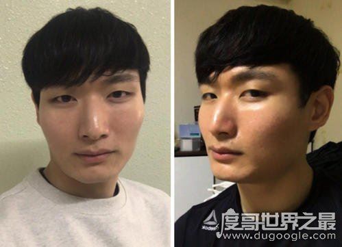 最丑的几种鼻子图片，每一种都会拉低颜值(塌鼻子大家公认最丑)