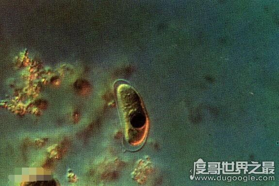生存在海底1万米下的生物，巨型阿米巴虫(单个细胞直径超过10CM)