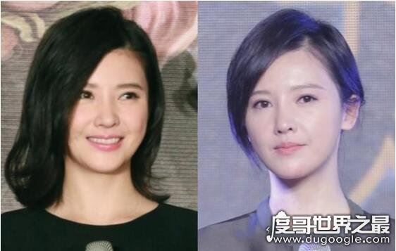 戚薇整容前后大对比，割了双眼皮竟然美成仙