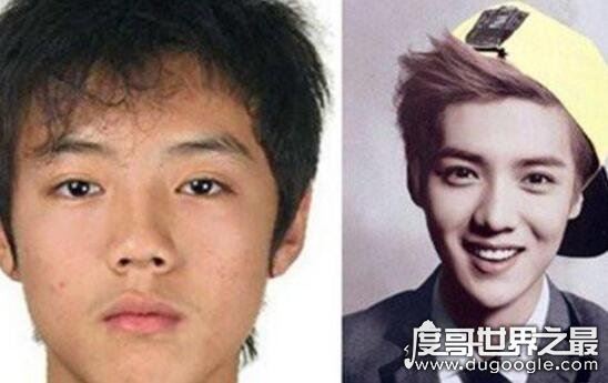 戚薇整容前后大对比，割了双眼皮竟然美成仙