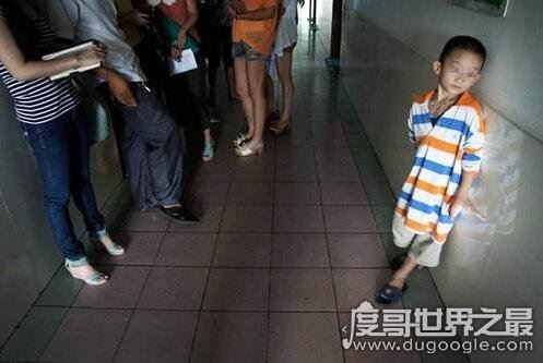 天生畸形的螃蟹手,8岁男童被丢弃三次终被治愈