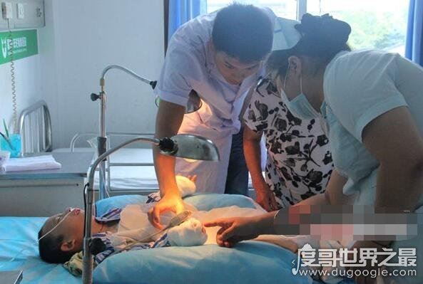 天生畸形的螃蟹手，8岁男童被丢弃三次终被治愈