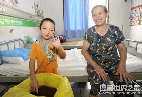 天生畸形的螃蟹手，8岁男童被丢弃三次终被治愈