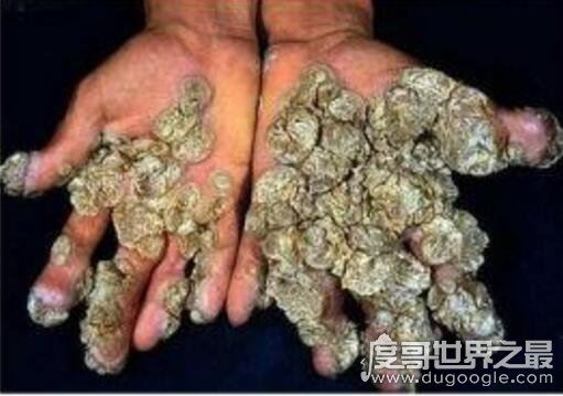 史上最全的空手指图片，空手指莲蓬乳合集(能看完算你叼)