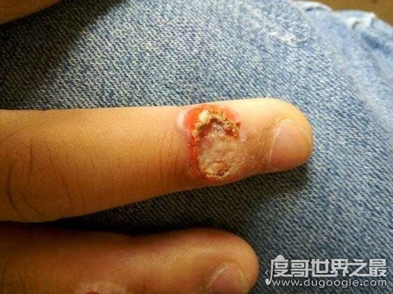 史上最全的空手指图片，空手指莲蓬乳合集(能看完算你叼)