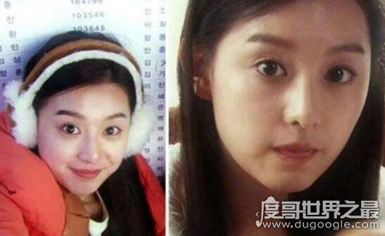 金智媛整容前后照片对比,16岁被星探发掘微整过