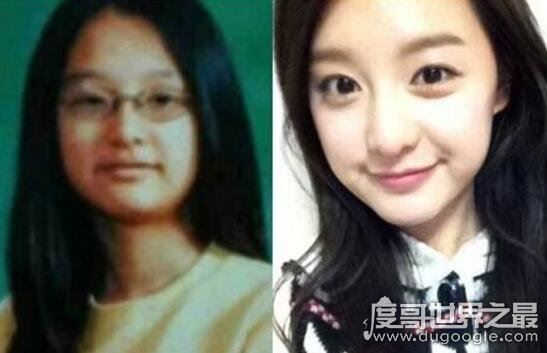 金智媛整容前后照片对比，16岁被星探发掘微整过