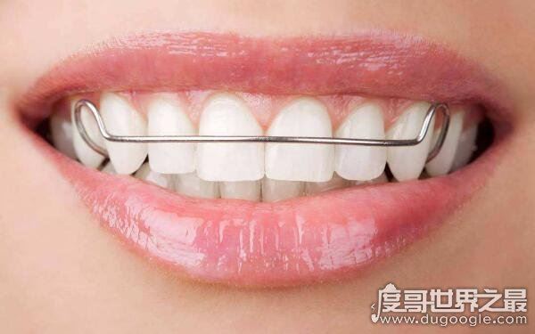 整牙的三大误区，成年以后千万别整牙是真的吗（矫正前必备常识）