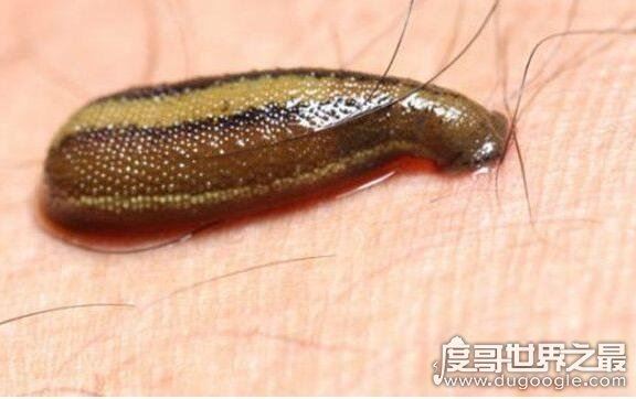 蚂蟥最怕什么，因为没有皮肤最怕盐了(会让它脱水而死)