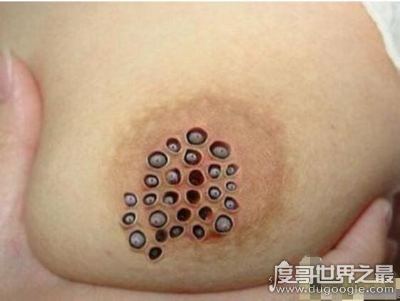 超恶心的密集恐惧症图片大全,密集测试图欢迎挑战(慎入)