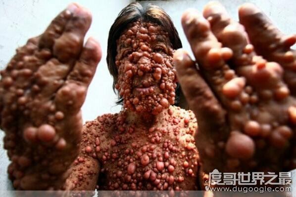 超恶心的密集恐惧症图片大全，密集测试图欢迎挑战(慎入)